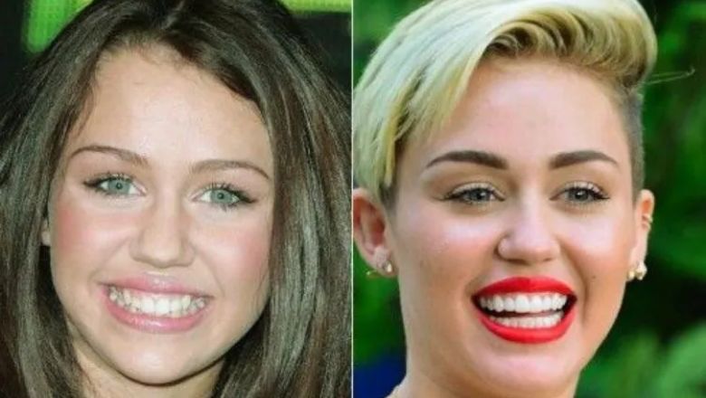 Miley Cyrus carilla dental