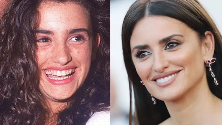 Penélope Cruz carilla dental