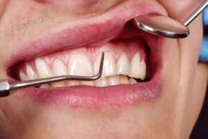 Tratamiento periodontal