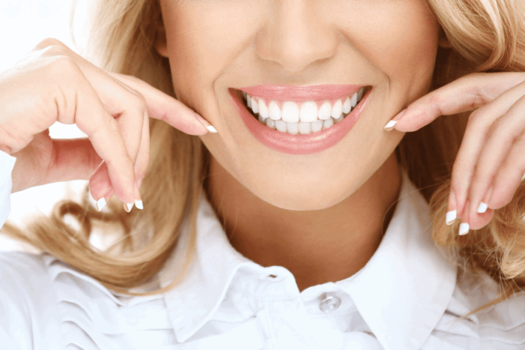 diseño de sonrisa