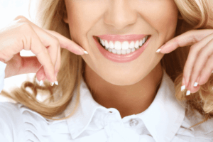 diseño de sonrisa