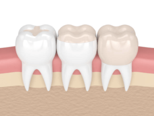 Empaste dental