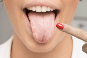 saliva espesa