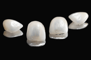 carilles dentals