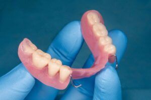 Pròtesi dental removible parcial