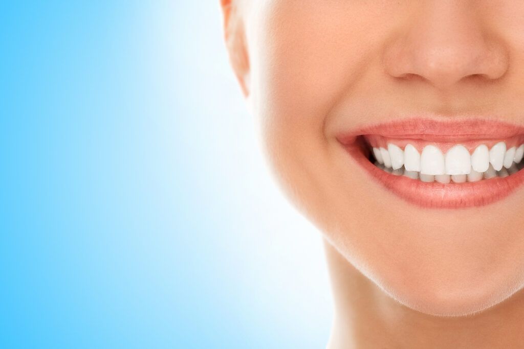sonrisa perfecta