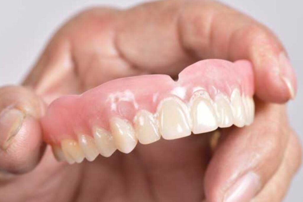 protesis dental removible