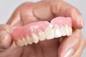 protesis dental removible
