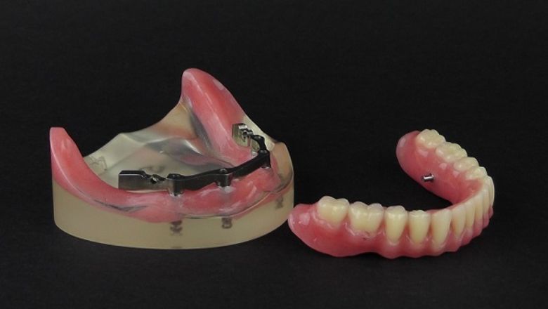 lo ultimo en protesis dental removible