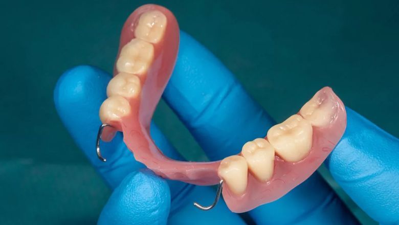 lo ultimo protesis dental removible