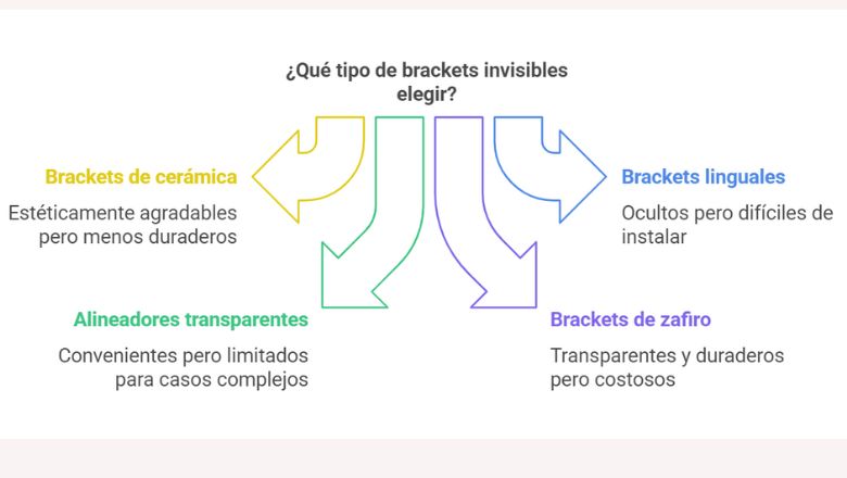 tipos de bracket invisible