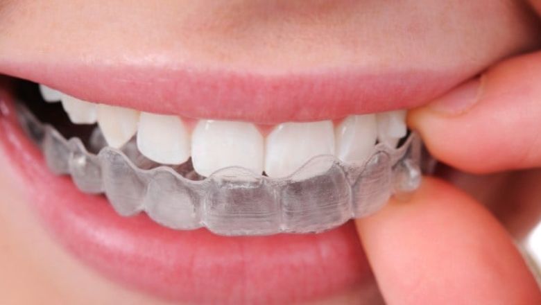Què són els brackets invisibles_?