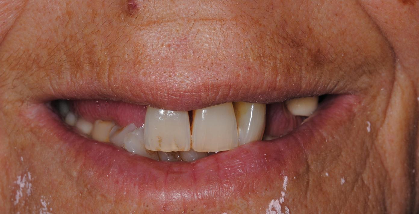 antes del tratamiento dental