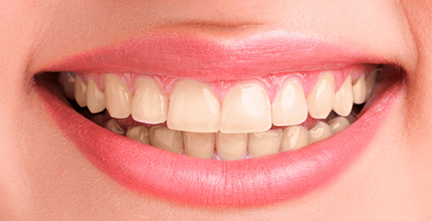 dientes1