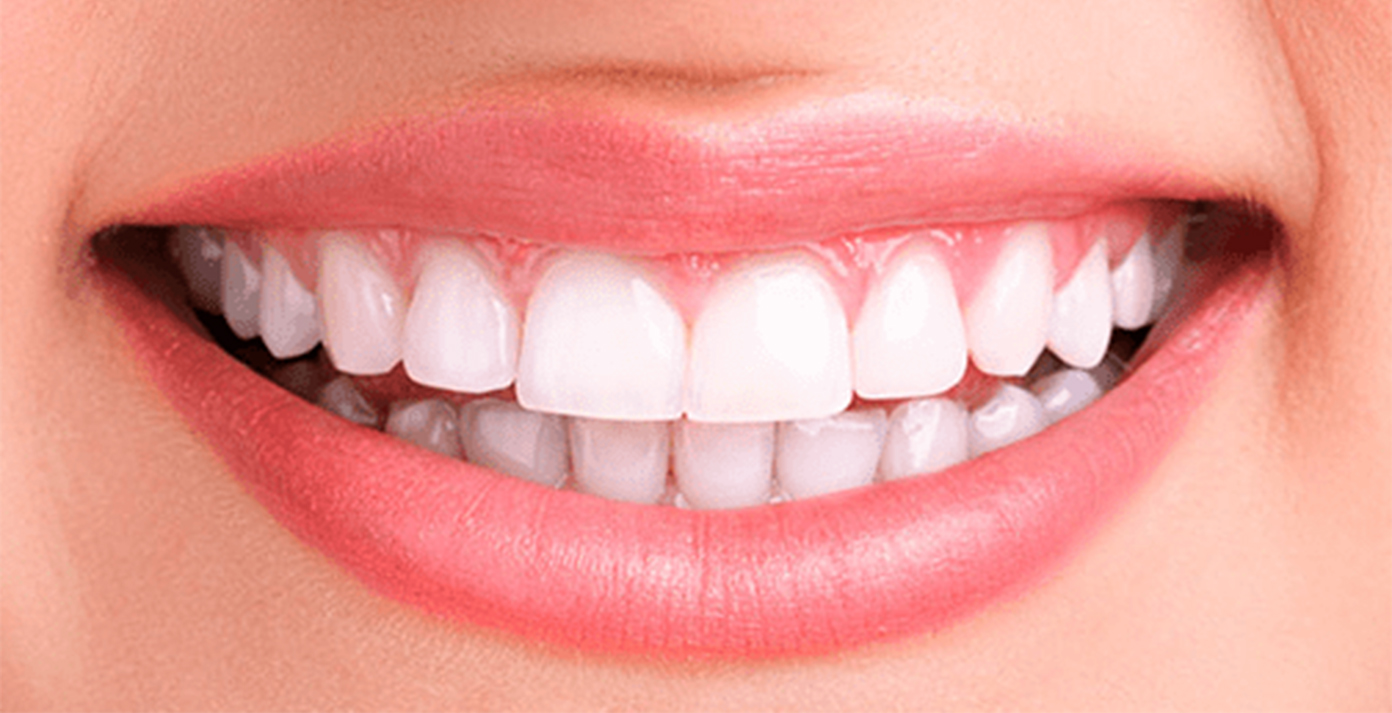 dientes2