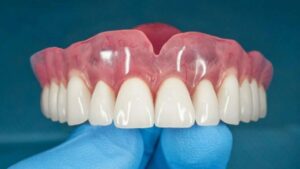 precio de una protesis dental removible