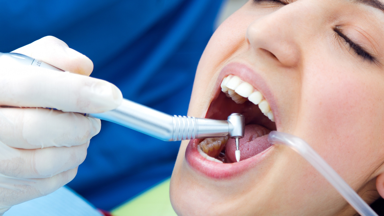 Limpieza dental