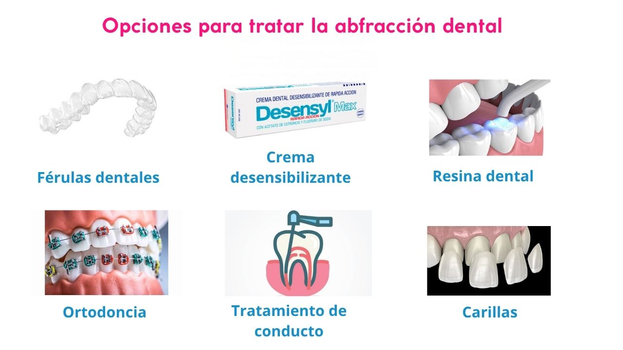 Opciones para tratar la abfracción dental