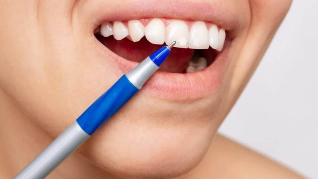 ¿Qué significan las manchas blancas en los dientes y cómo eliminarlas_