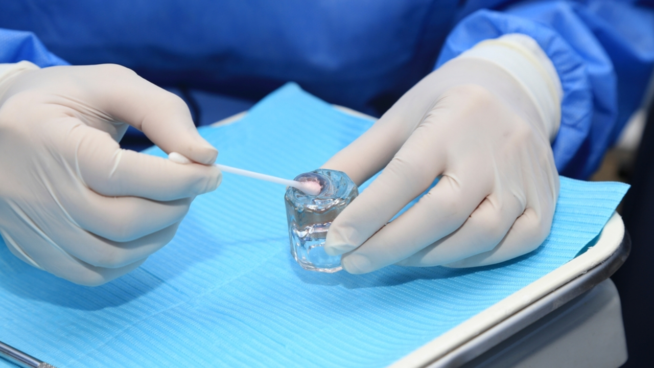 Aplicación de gel con flúor