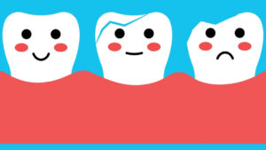 Descubre cómo tratar el esmalte dental desgastado y protege tus dientes