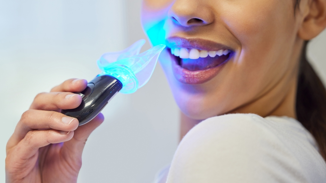 Tipos de blanqueamiento dental: ¿Cuál es el que funciona mejor?