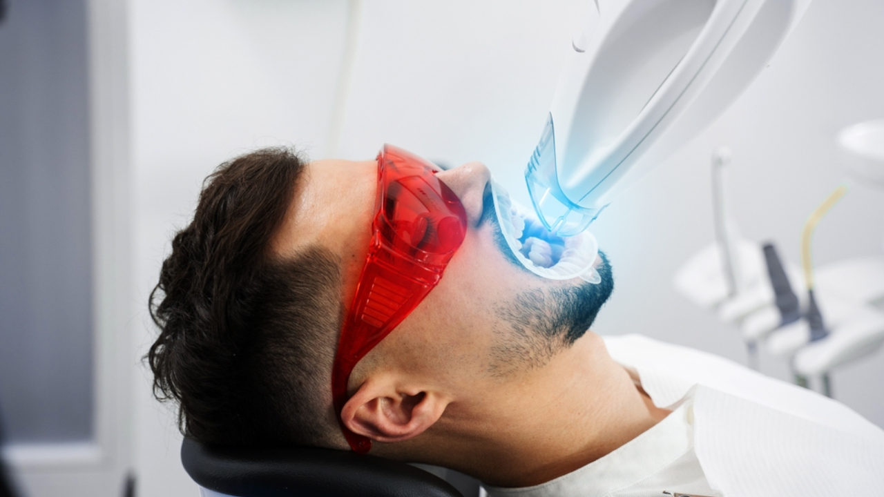 Ventajas y desventajas del blanqueamiento dental