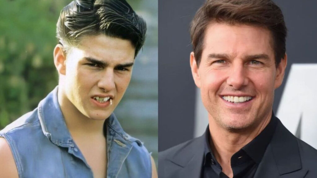 Famosos con ortodoncia: Antes y después que te sorprenderán