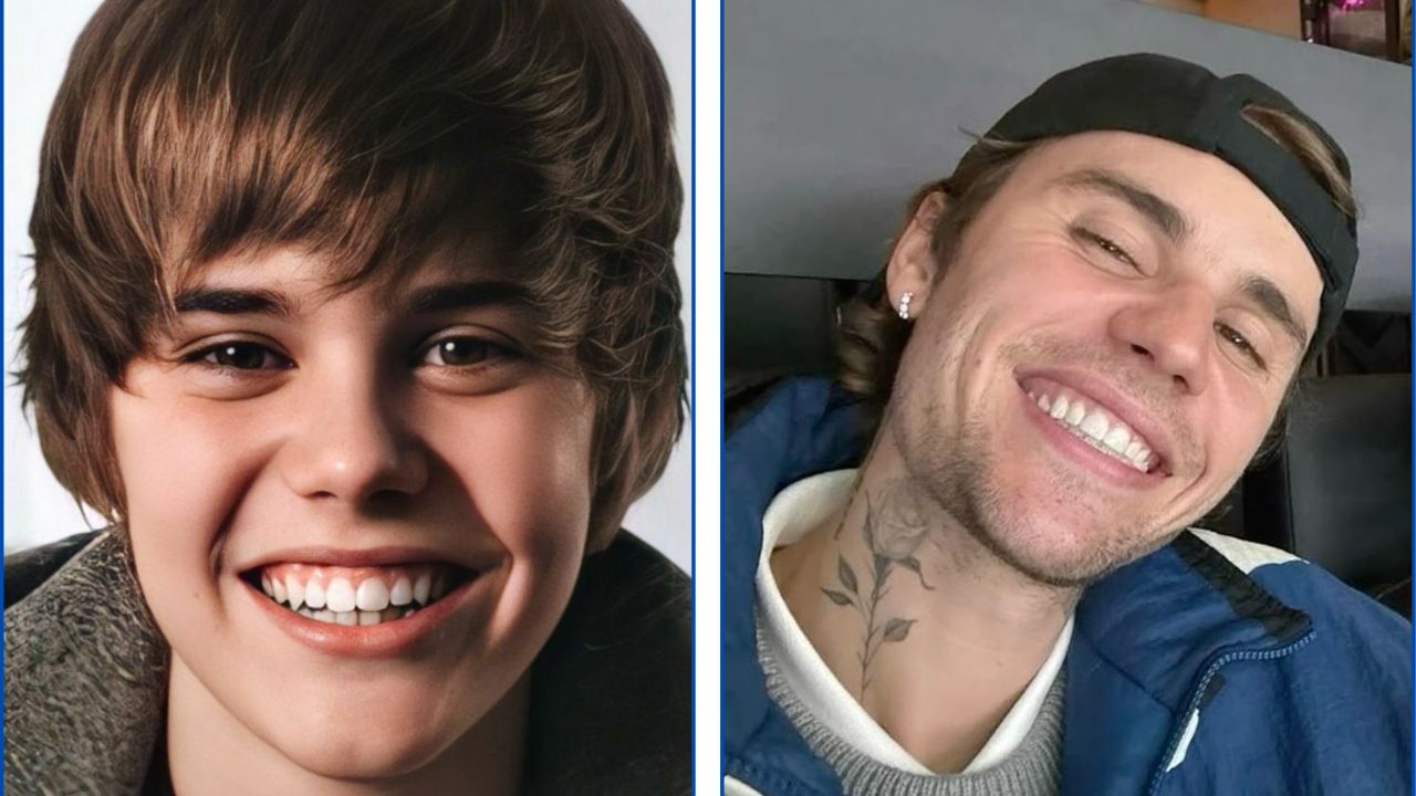 Justin Bieber con ortodoncia antes y después