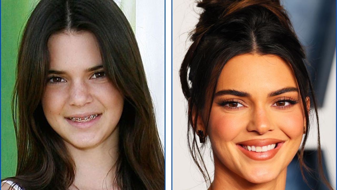 Kendall Jenner con ortodoncia antes y después