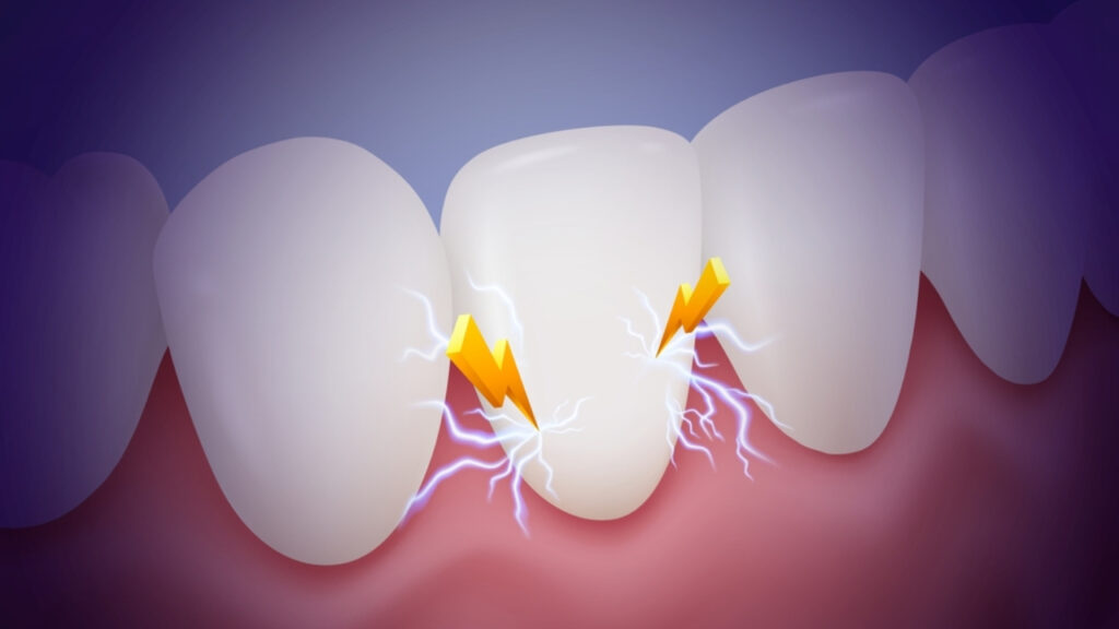 Sensibilidad dental: Causas, síntomas y cómo tratarla efectivamente