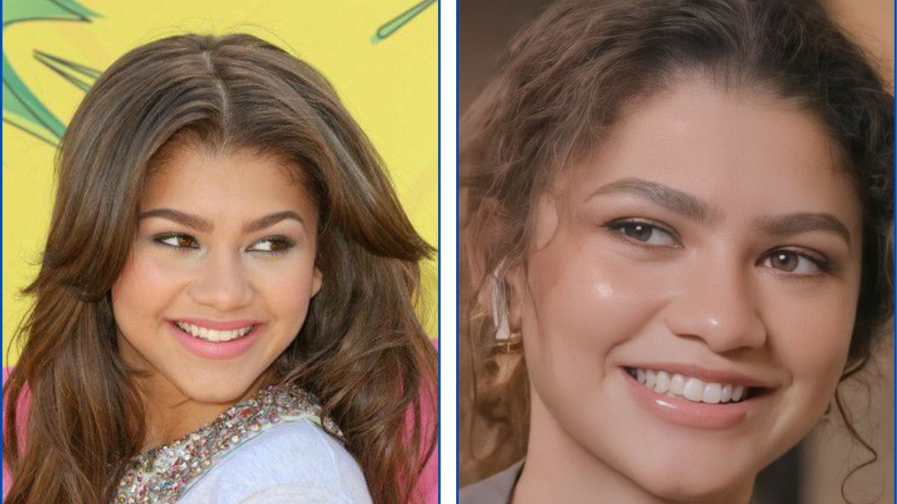 Zendaya con ortodoncia antes y después