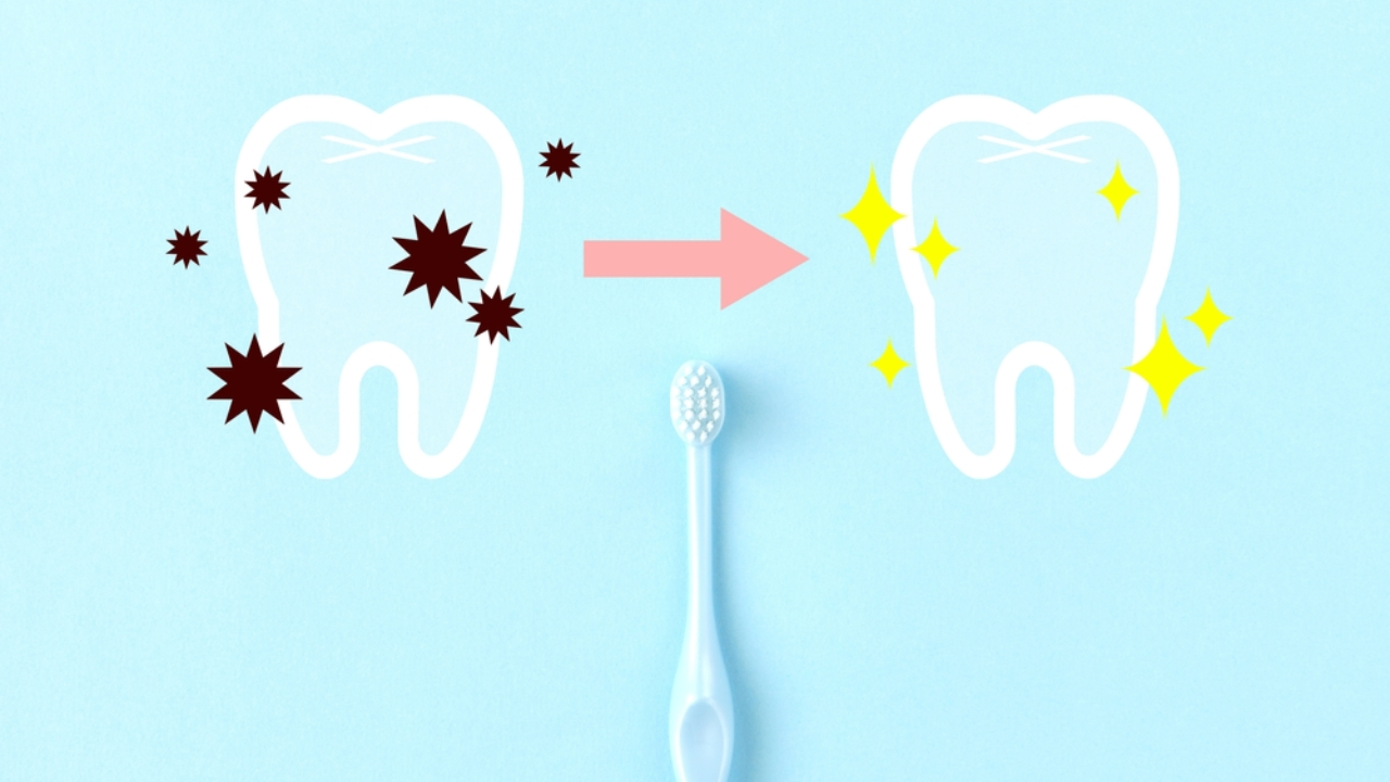 Cómo identificar y tratar las caries interproximales antes de que avancen