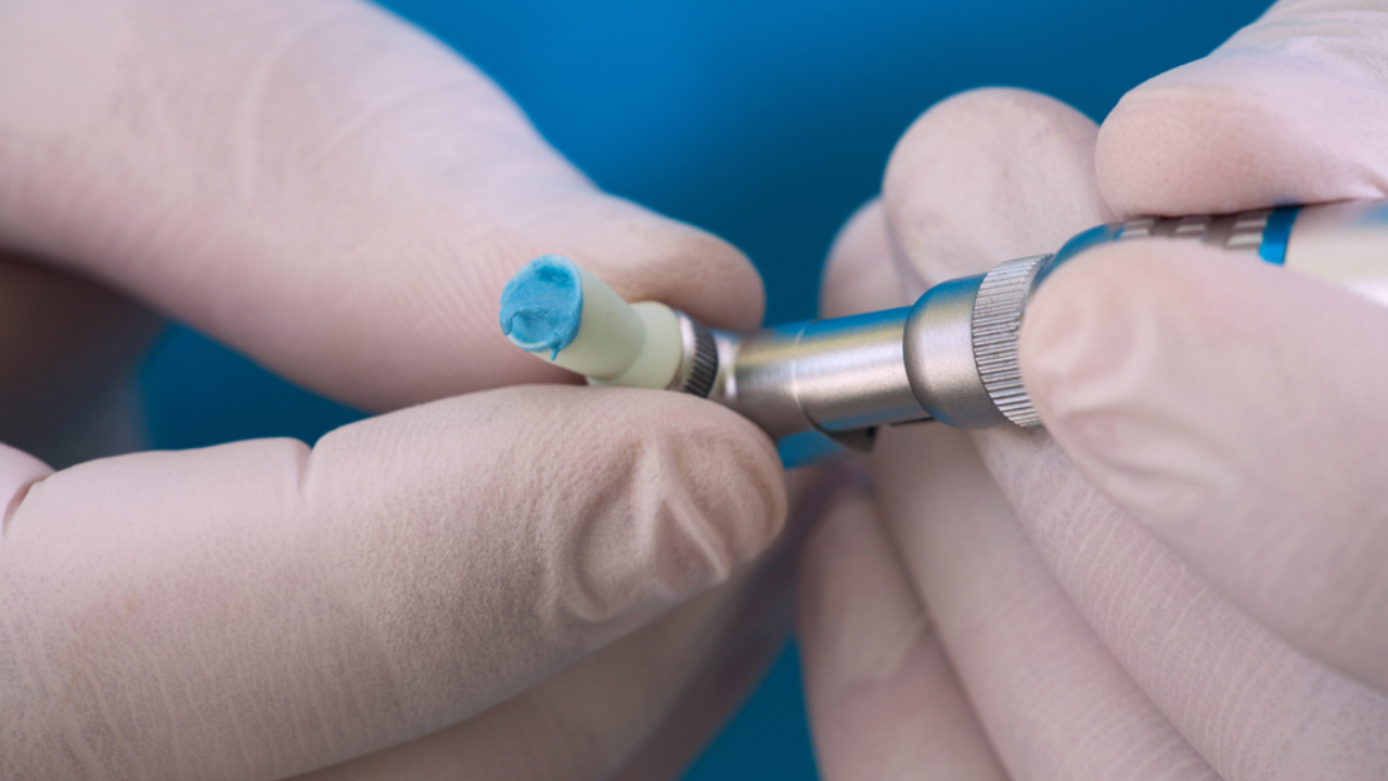 Micro abrasión dental para tratar hipoplasia