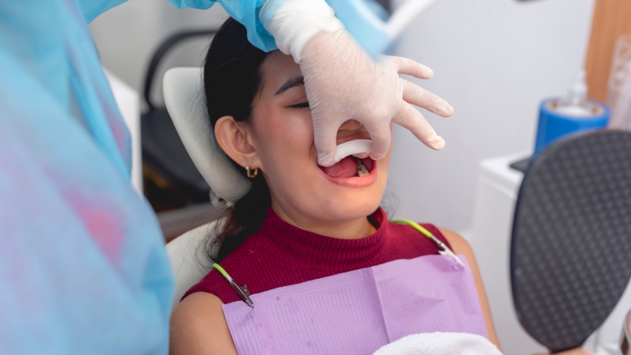 Tratamiento de fluorización para corregir hipoplasia dental