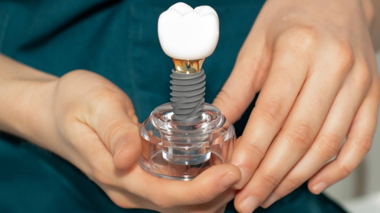 10 problemas implantes dentales y cómo solucionarlos