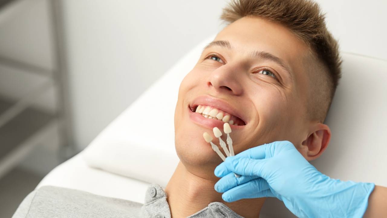 Carillas dentales para dientes amarillos