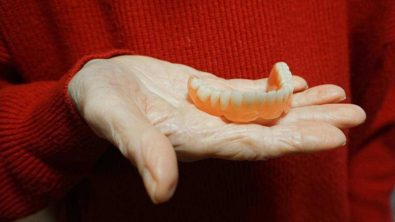 Prótesis dentales removibles